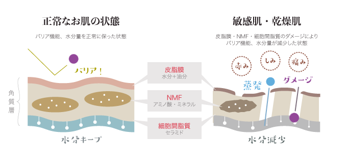 敏感肌の原因は？